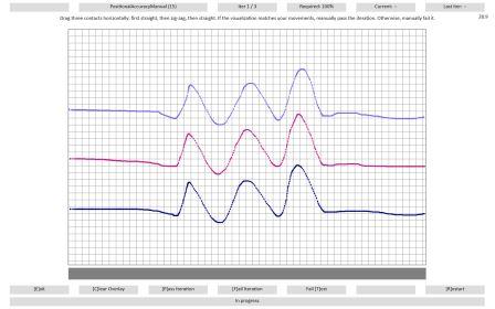 Positioniergenauigkeit Iteration 1