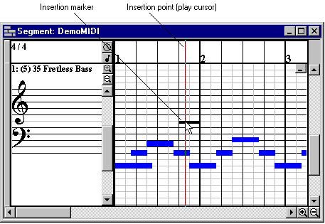 Insertion point in editing window