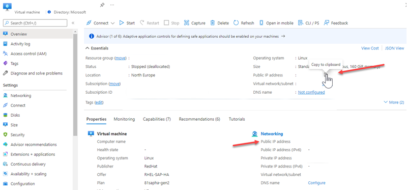 Où récupérer l’adresse IP publique sur le portail Azure